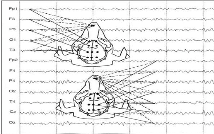 Electroencefalograma veterinaria